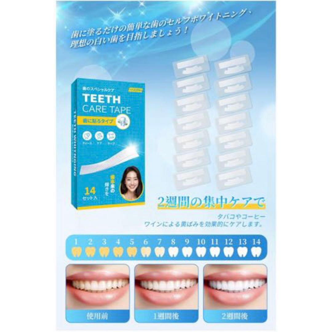 【New!❣️】Whitening Sheets - 14 Day Supply (28 Sheets) - Teeth Whitening